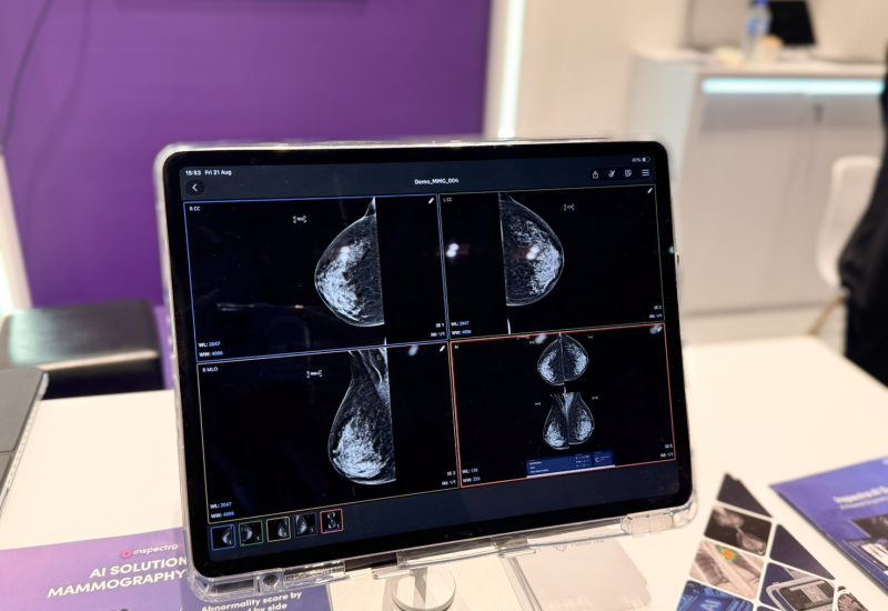 Perceptra, a Thai Startup, Brings Medical AI to International Markets to Enhance Regional Patient Screening